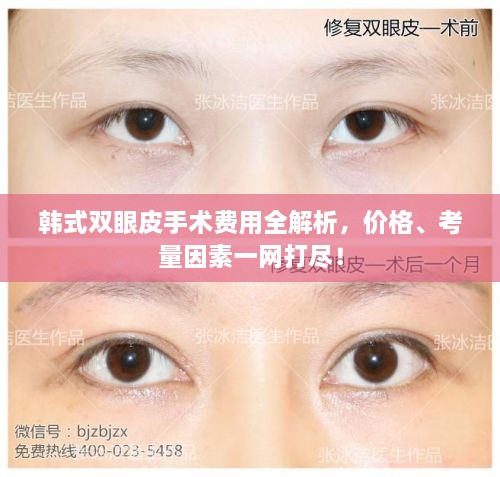 韓式雙眼皮手術(shù)費用全解析，價格、考量因素一網(wǎng)打盡！