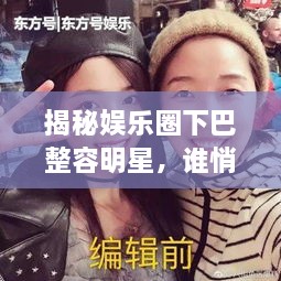 揭秘娛樂圈下巴整容明星，誰悄悄整過下巴？