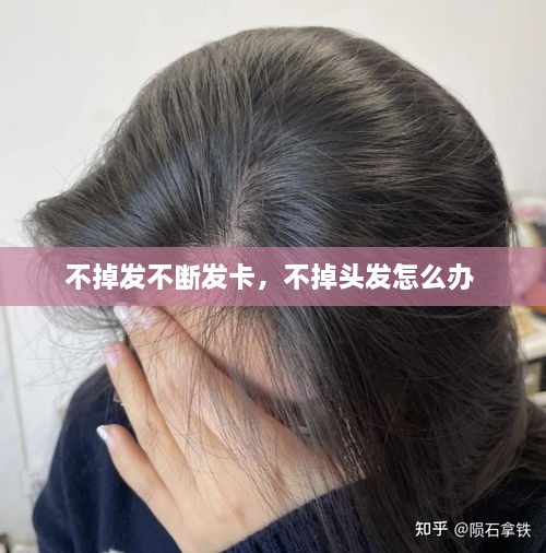 不掉發(fā)不斷發(fā)卡，不掉頭發(fā)怎么辦 
