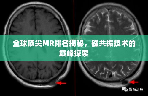 全球頂尖MR排名揭秘，磁共振技術(shù)的巔峰探索