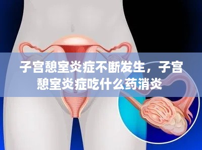 子宮憩室炎癥不斷發(fā)生，子宮憩室炎癥吃什么藥消炎 