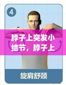脖子上突發(fā)小結(jié)節(jié)，脖子上的小結(jié)節(jié)要緊嗎 