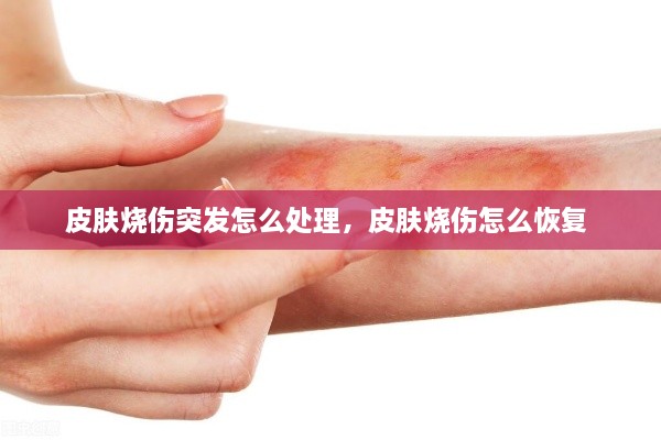 皮膚燒傷突發(fā)怎么處理，皮膚燒傷怎么恢復(fù) 